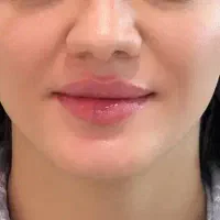 انجام خدمات زیبایی با قیمت مناسب توسط پزشک