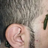 چکاپ کلی خدمات طب سنتی حجامت زالو بادکش فصد|خدمات آرایشگری و زیبایی|اصفهان, برازنده|دیوار