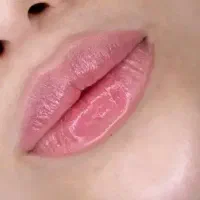 تزریق ژل فیلر و بوتاکس کل صورت ،ژل لب، چونه،گونه|خدمات آرایشگری و زیبایی|مشهد, ادیب نیشابوری (شهرک غرب)|دیوار