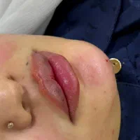 ژل لب مادلینگ کانتورینگ بوتاکس فیلرزیرچشم فیلربادی|خدمات آرایشگری و زیبایی|تهران, سید خندان (جلفا)|دیوار