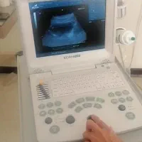 سونوگرافی فول ابشن وکلیه وسایل مطب زنان زایمان
