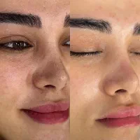 فیشال تخصصی و مراقبتهای پوستی