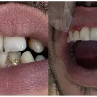 انجام کلیه خدمات دندانپزشکی قرارداد بانک سپه ورفاه|خدمات آرایشگری و زیبایی|فلاورجان, |دیوار