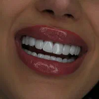 کامپوزیت دندان از دم قسط