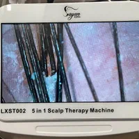 درمان قطعی شوره ،چربی،و انواع ریزش های مو|خدمات آرایشگری و زیبایی|اصفهان, چشمه باقرخان|دیوار