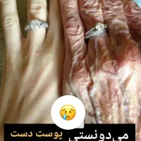 کرم جوانساز پوست دست و صورت|آرایشی، بهداشتی، درمانی|شیراز, بازار|دیوار