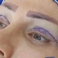 مدل بلفارو پلاستی لیفت ابرو کاشت ابرو سانترال لب|خدمات آرایشگری و زیبایی|تهران, پونک|دیوار