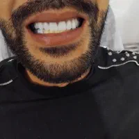 جشنواره دندان پزشکی دندانسازی  فقط 20میلیون
