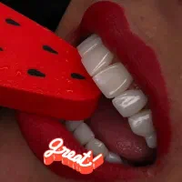 کامپوزیت ونیر اقساطی.روکش ایمپلنت