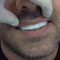 کامپوزیت دندان (( طرح لبخند ))|خدمات آرایشگری و زیبایی|یاسوج, |دیوار