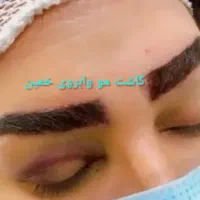 کاشت مو، ابرو، ریش در شهر خمین