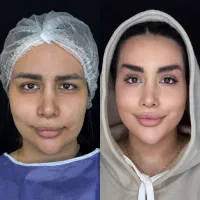 زیبایی ابرو و بلفارو|خدمات آرایشگری و زیبایی|تهران, سازمان برنامه جنوبی|دیوار