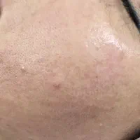 فیشال درمانی تخصصی