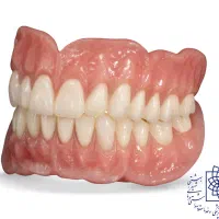 پروتز کامل ( دست دندان )برای بی دندانی کامل