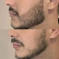 ریشت در نیومده راهکارش اینجاست