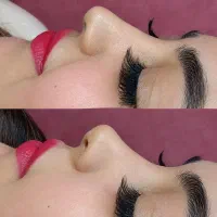 تخفیف ویژه ژل و بوتاکس اورجینال تضمینی