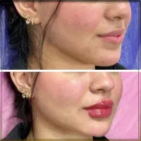 کلینیک زیبایی زکریا  خدمات تخصصی زیبایی|خدمات آرایشگری و زیبایی|مشهد, بهارستان|دیوار