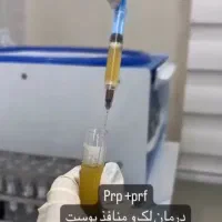 مدل فیلر و بوتاکس|خدمات آرایشگری و زیبایی|تهران, ائمه اطهار|دیوار