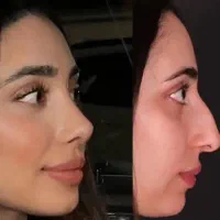 جراحی عمل بینی/لیپو ابدو/بلفارو/لیفت/لیپو ساکشن|خدمات آرایشگری و زیبایی|تهران, فلسطین (میدان انقلاب)|دیوار