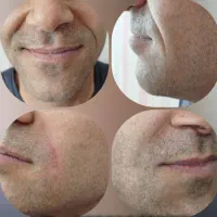 ژل و بوتاکس با ماندگاری بالا و قیمت ویژه|خدمات آرایشگری و زیبایی|شاهین‌شهر, شهرک گلدیس|دیوار