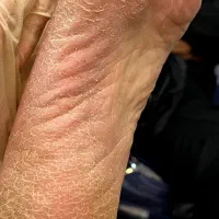 پدیکور فقط ۳۵۰|خدمات آرایشگری و زیبایی|ایذه, |دیوار