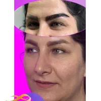 متخصص کاشت ابروتهران/قرینه/اقساطی|خدمات زیبایی و سلامت|تهران, صادقیه|دیوار