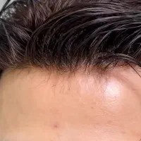 تخصصی ترین مجموعه پروتز مو در تهران ( نقد و اقساط)|آرایشی، بهداشتی، درمانی|تهران, صادقیه|دیوار