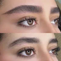 فیبروزکرکی مویی،شیدینگ لب