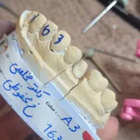 تکنسین قالبریز و کارآموز دستیاری دندانپزشکی