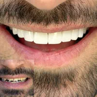 دندانپزشکی با کیفیت بصورت اقساطی|خدمات آرایشگری و زیبایی|شیراز, قدوسی غربی|دیوار