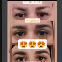 آیا علت ریزش مو را میدانید