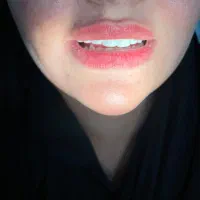 تخفیف ویژه l کامپوزیت