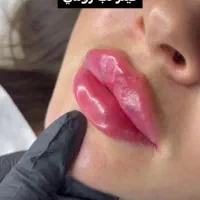 جشنواره ژل و بوتاکس و مزوژل|خدمات آرایشگری و زیبایی|تهران, ظفر|دیوار