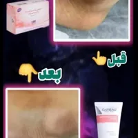نمایندگی پکیج تضمینی روشن کننده بدن ((اصلی))|آرایشی، بهداشتی، درمانی|تهران, ونک|دیوار