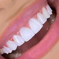 جشنواره دندانپزشکی(ایمپلنت،لمینت،کامپوزیت،عصبکشی و|خدمات آرایشگری و زیبایی|شیراز, فرهنگ شهر|دیوار