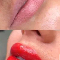 تزریق ژل وبوتاکس(سی سی ۵۰۰)ارایش دائم صورت،پیرسینگ|خدمات آرایشگری و زیبایی|آزادشهر, |دیوار