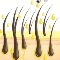 تونیک ضد ریزش و محرک رشد مجدد مو با اپلیکاتور|آرایشی، بهداشتی، درمانی|بابل, |دیوار