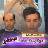 پروتز مو هالیوودی سینمایی