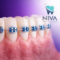 دندانپزشکی نیوا|خدمات آرایشگری و زیبایی|تهران, اختیاریه|دیوار