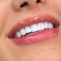خدمات دندان پزشکی به مدت ۲۰ روز تخفیف