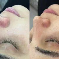 فشیال با تخفیف ویژه فقط فقط ۱ هفته