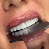 جشنواره کامپوزیت /روکش