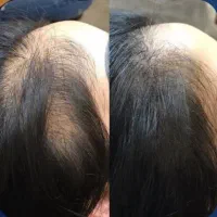 پیشگیری بهتر از درمانه