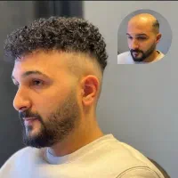 پروتز مو  سنندج|خدمات آرایشگری و زیبایی|سنندج, |دیوار