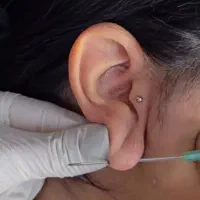 اموزش فشیال و پیرسینگ و prpوخالبرداری