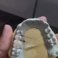 دندانسازی تاکستان|پزشکی|تاکستان, |دیوار