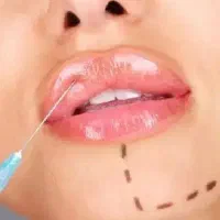 کلاس های اموزشی و تزریق ژل ،فیلر تخصصی