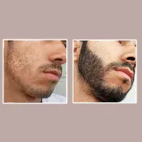 ریشاتو باما پرحجم کن