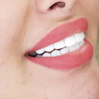 کشیدن دندان