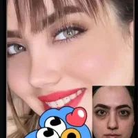 مرکزفوق تخصصی جراحی بینی/وجشنواره۱۰روزهشگفت انگیز|خدمات آرایشگری و زیبایی|مشهد, احمدآباد|دیوار